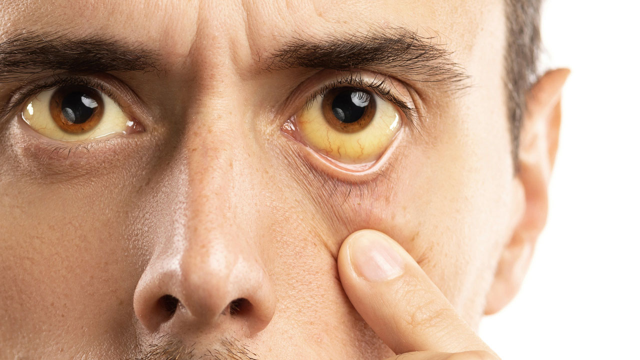 腹腔镜下胆总管切开取石治疗,充填型胆囊结石用腹腔镜怎样切除