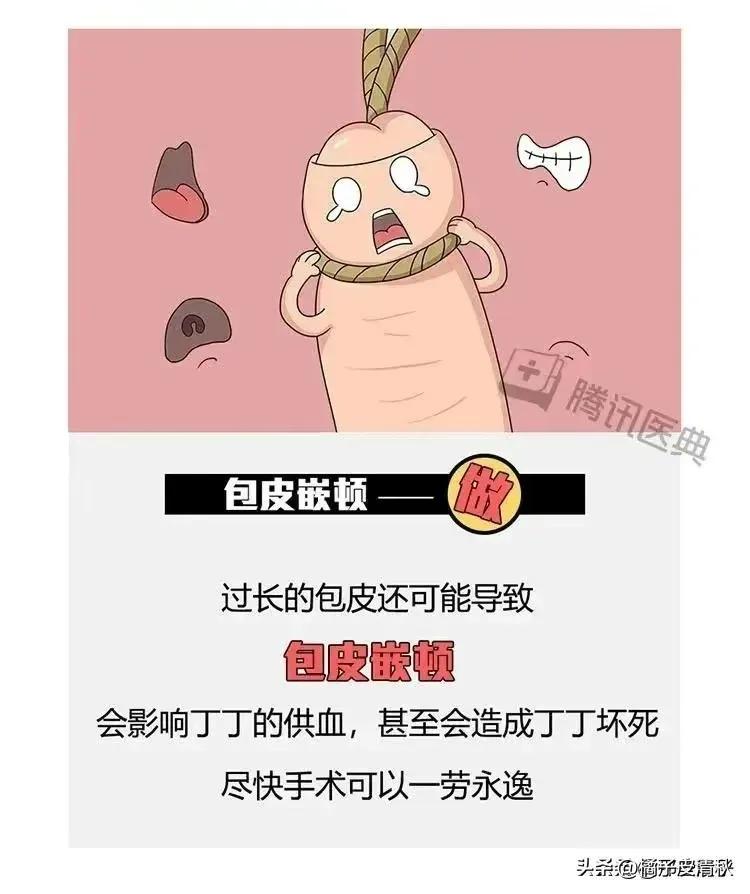 割完包皮后要恢复多久,割完包皮之后要多久恢复