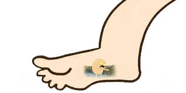 夏天脚气发作脚痒难忍用什么药膏,脚气痒脱皮有小水泡治疗小妙招