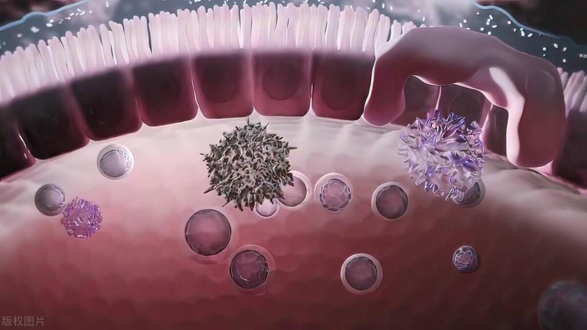 细胞瘤最好的治疗方法,除了遗传什么原因会掉头发