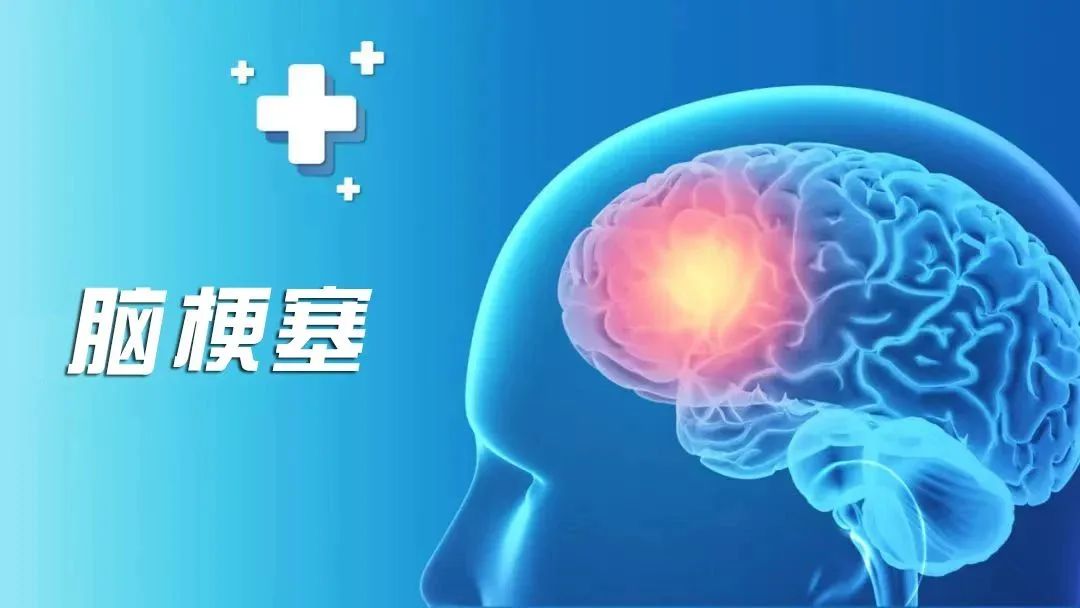 三氧血液疗法治疗脑梗塞,三氧疗法治脑梗需输液吗