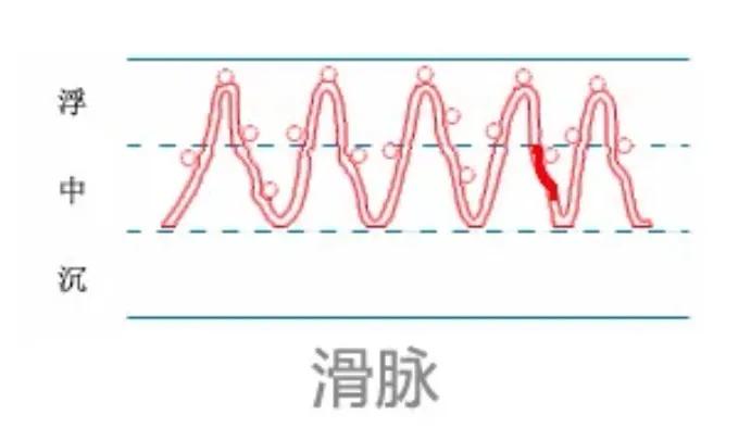 中医28脉诊歌诀及示意图,中医28脉全部脉象图解
