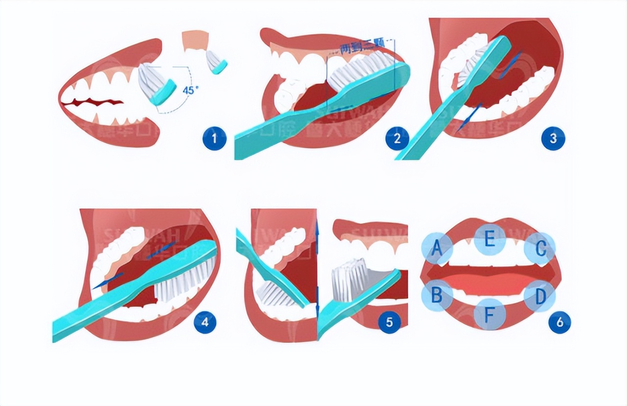 疫情期间牙疼厉害怎么办,疫情期间牙痛怎么办呢