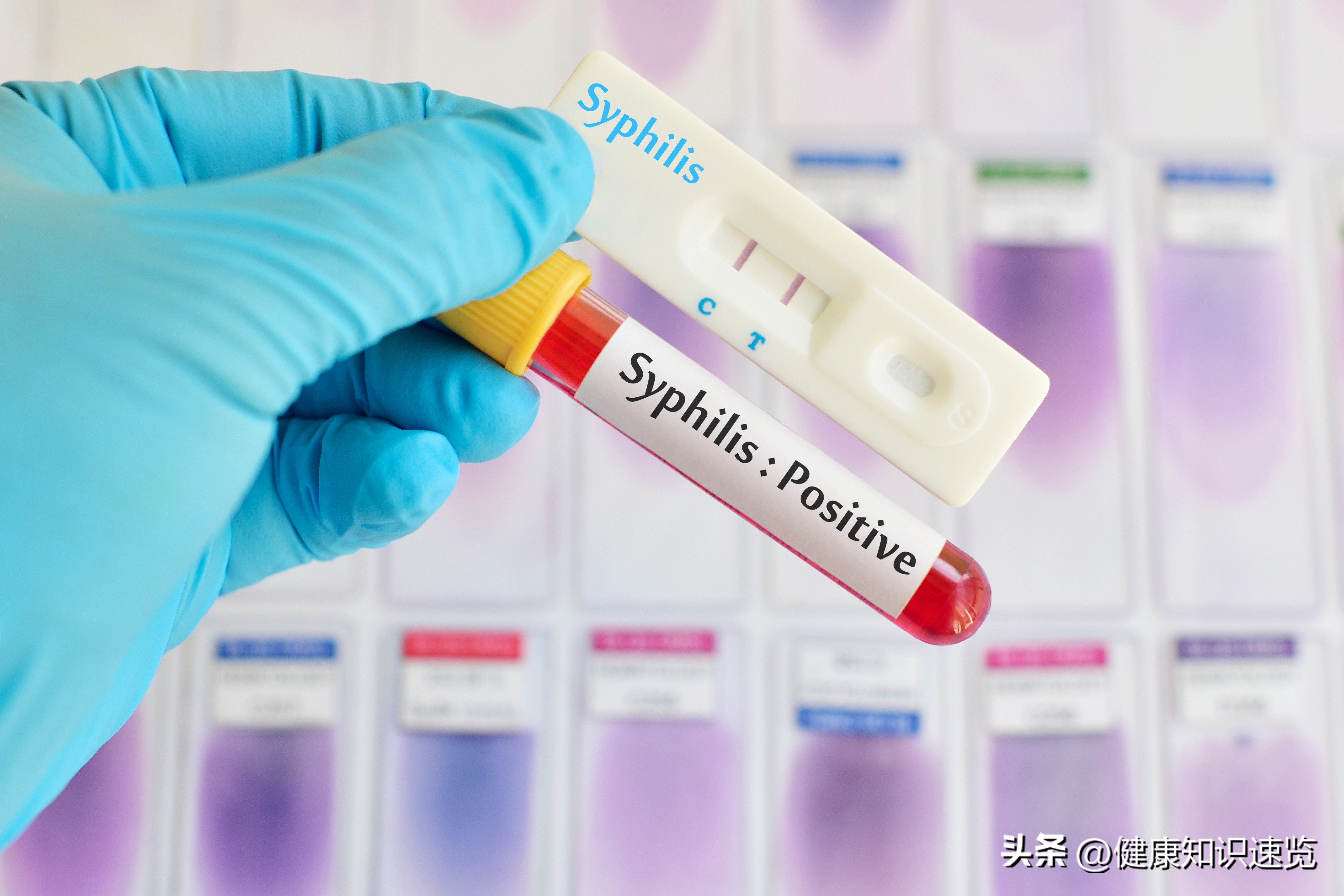 婚前查出梅毒抗体,梅毒治疗好婚前体检可以通过吗