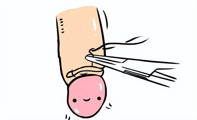 阴茎受伤了怎么办？应对阴茎外伤的实用指南！