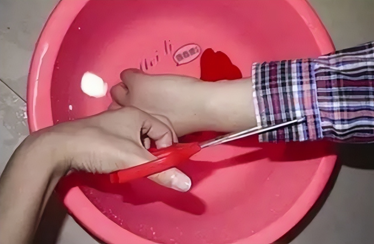 孩子被烫到，是先冲冷水还是先脱衣服？第一步做错，伤情更严重