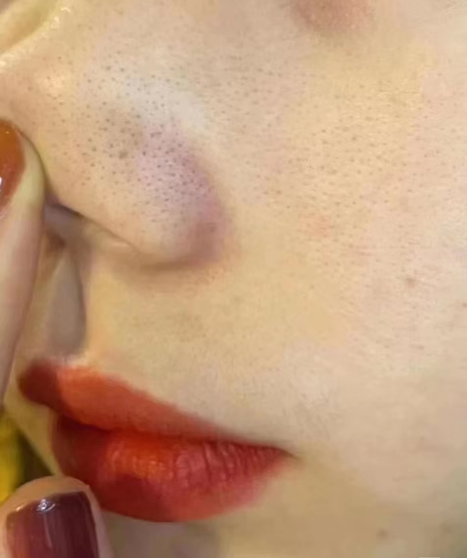 抗老去黑精华推荐,40岁抗老精华哪款最好用