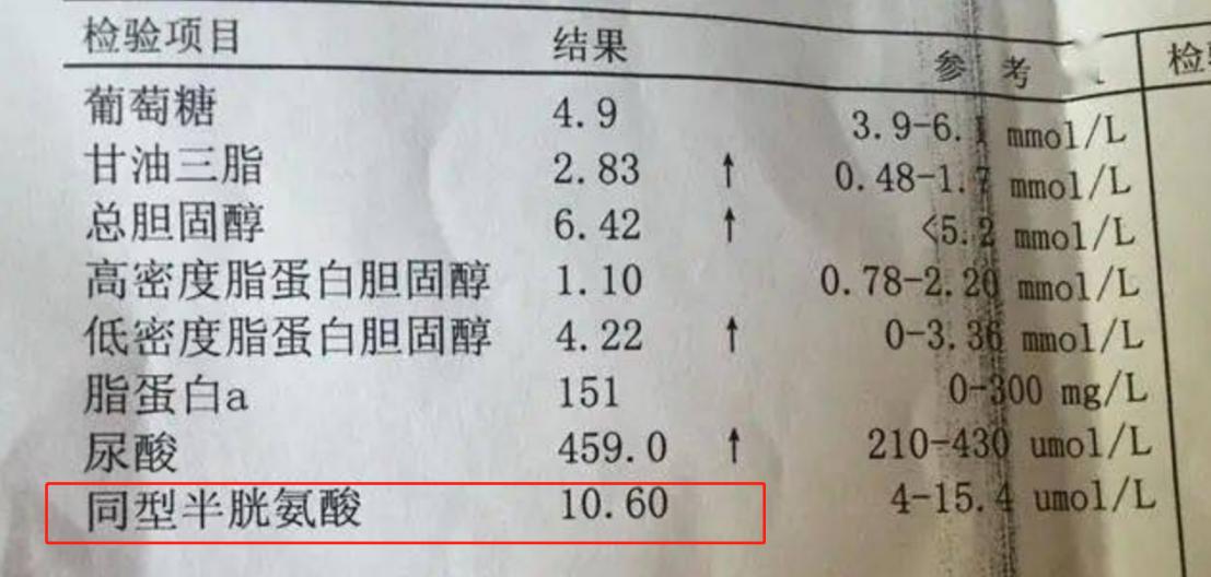 同型半胱氨酸高吃什么能降下来,同型半胱氨酸升高该吃什么药