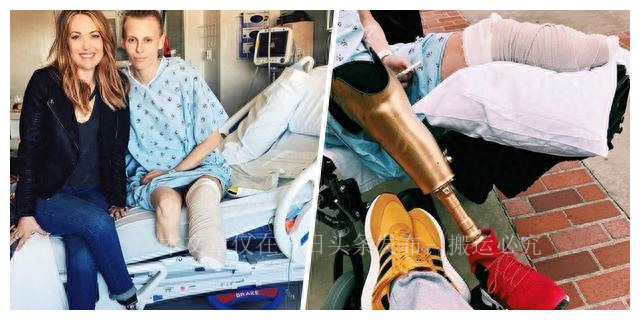 因为卫生棉条截肢的女孩,因卫生棉条截肢