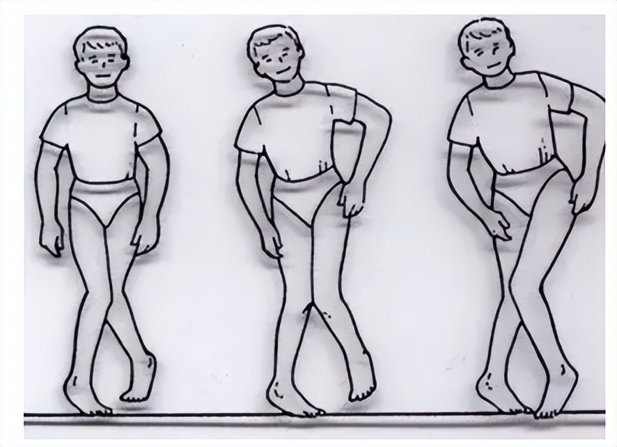 孩子走路姿势不对形象图,孩子走路姿势太丑要不要纠正