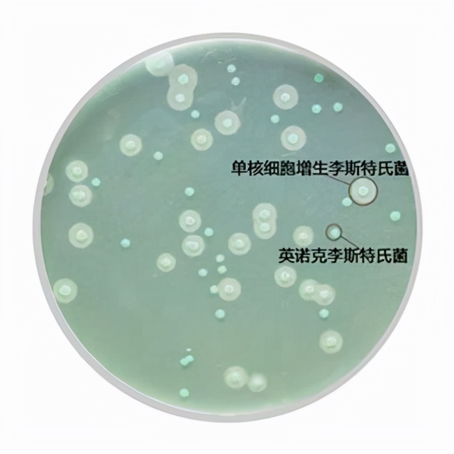 食源性过敏原,食源性致病菌引发的国际案例