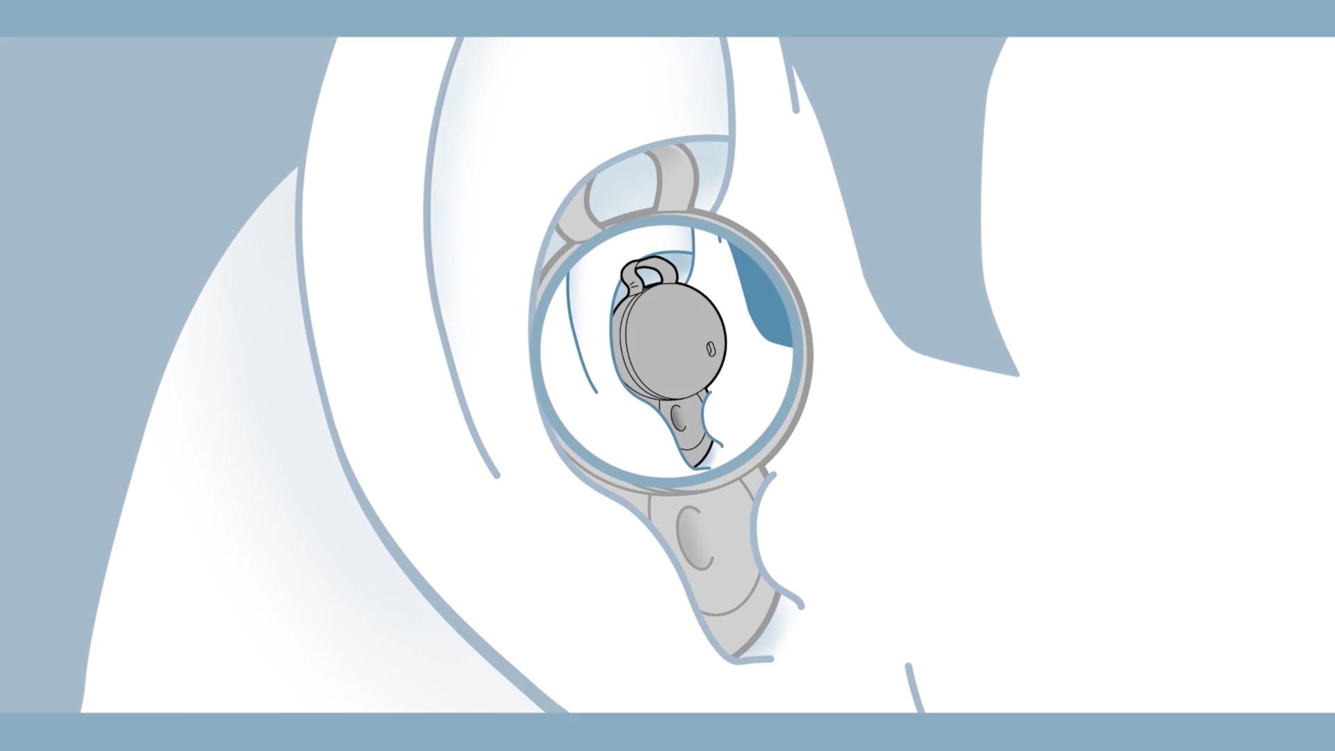 索尼新款无线降噪耳机linkbudswf-l900,索尼linkbudss和漫步者neobuds2