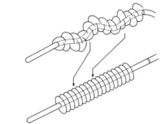 结肠镜检查术教学,结肠镜操作技巧与图解