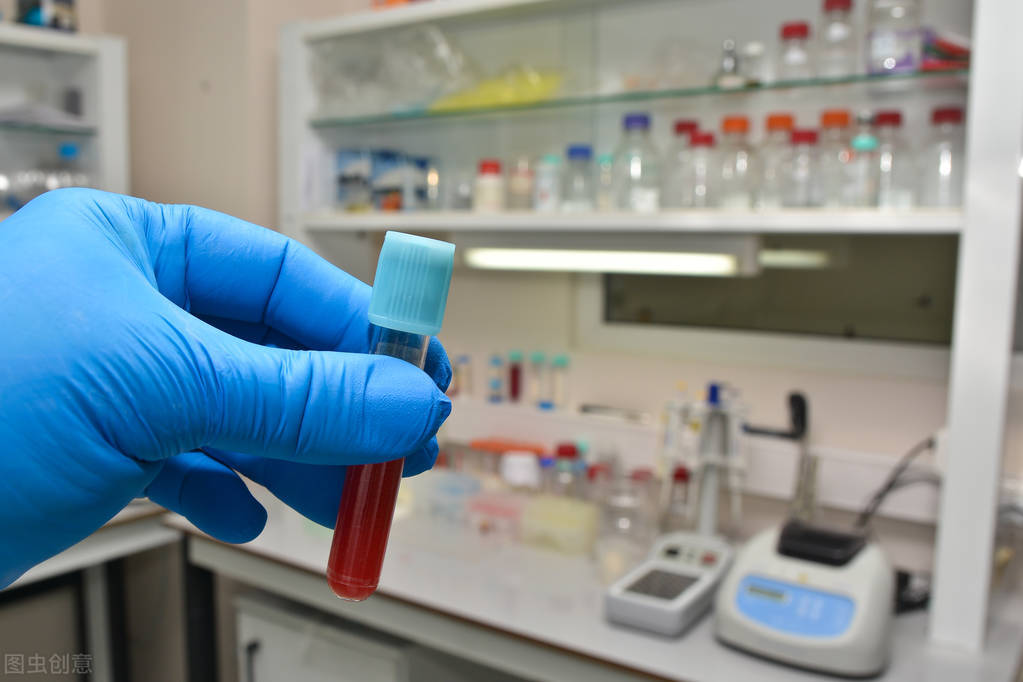 脑卒中复查有哪些项目,脑卒中复查要做哪些检查