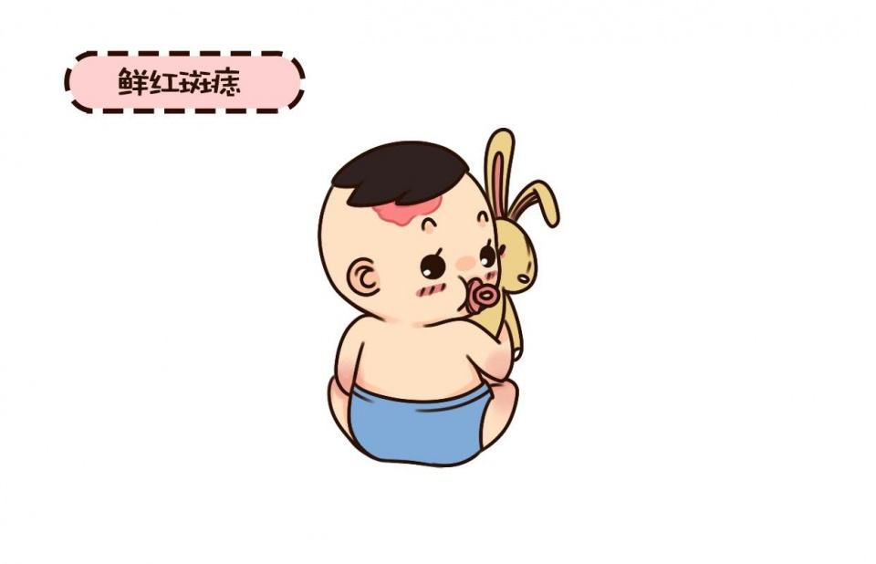 血管瘤胎记微创手术一般要多少钱,胎记与血管瘤的区别