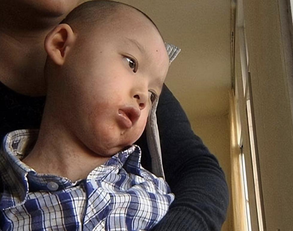 给孩子洗药浴洗出绝症,宝妈带孩子洗药浴染绝症