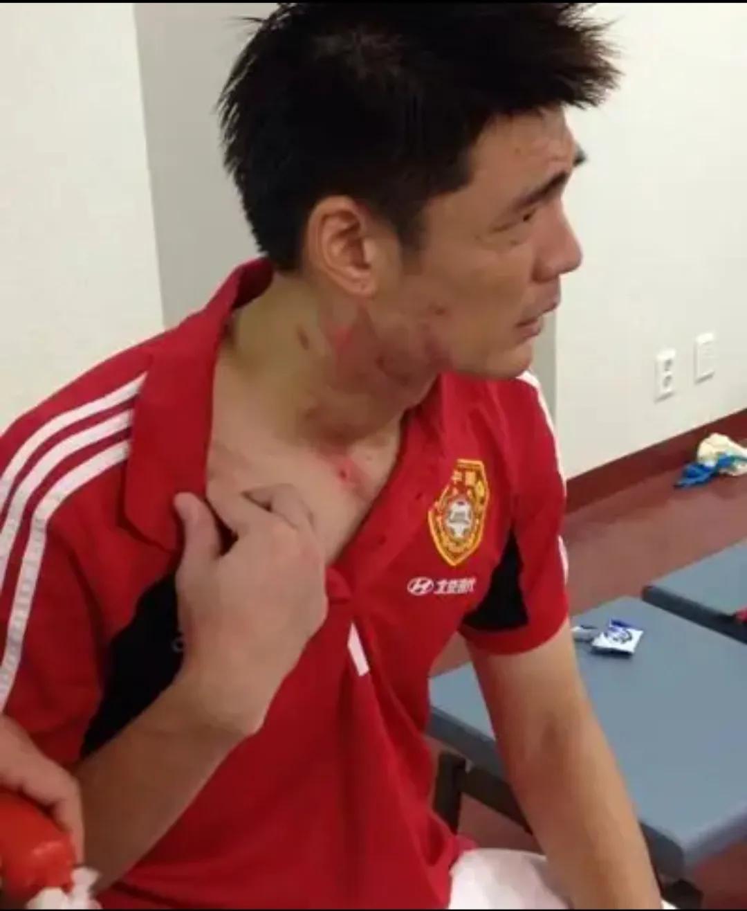 最佳门将曾诚近况,硬汉曾诚