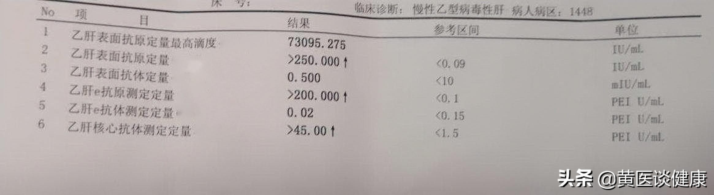 乙肝dna10的8次方能打干扰素吗,乙肝dna定量10的8次方需要抗病毒吗