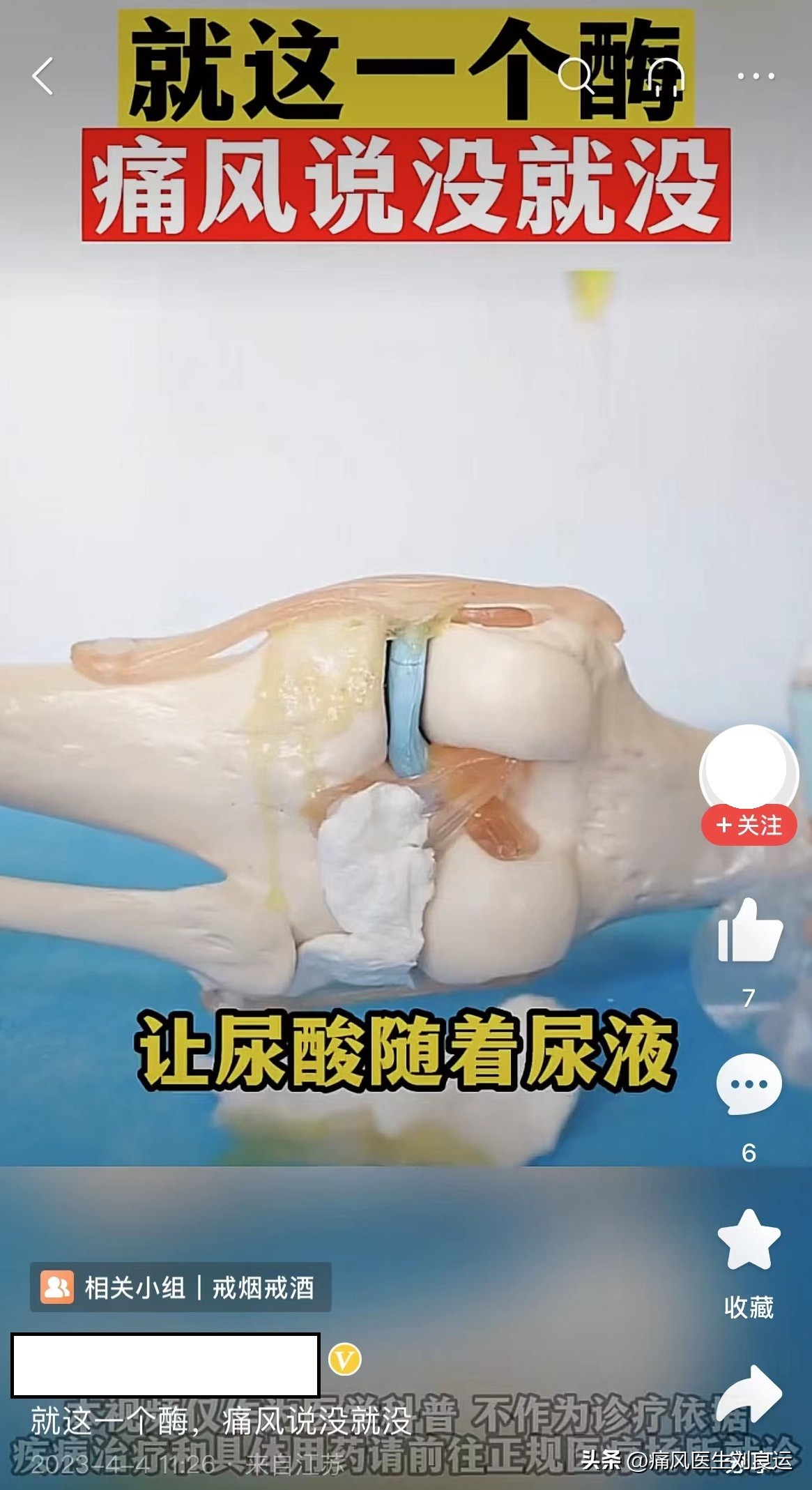 尿酸酶和非布司他,用了非布司他痛风持续发作