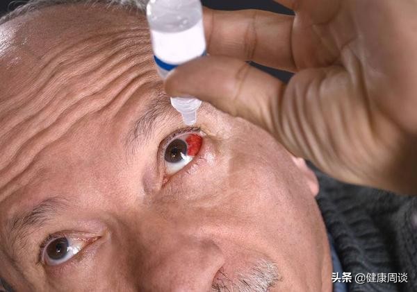 结膜炎和红眼病的症状有什么不同,结膜炎红眼病的6大表现症状