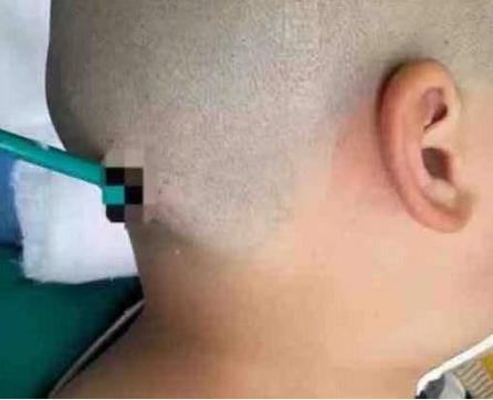 11岁男孩因写作业和父母吵架,因写作业与家长争执