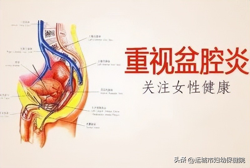 科普｜如何预防女性盆腔炎的发生？