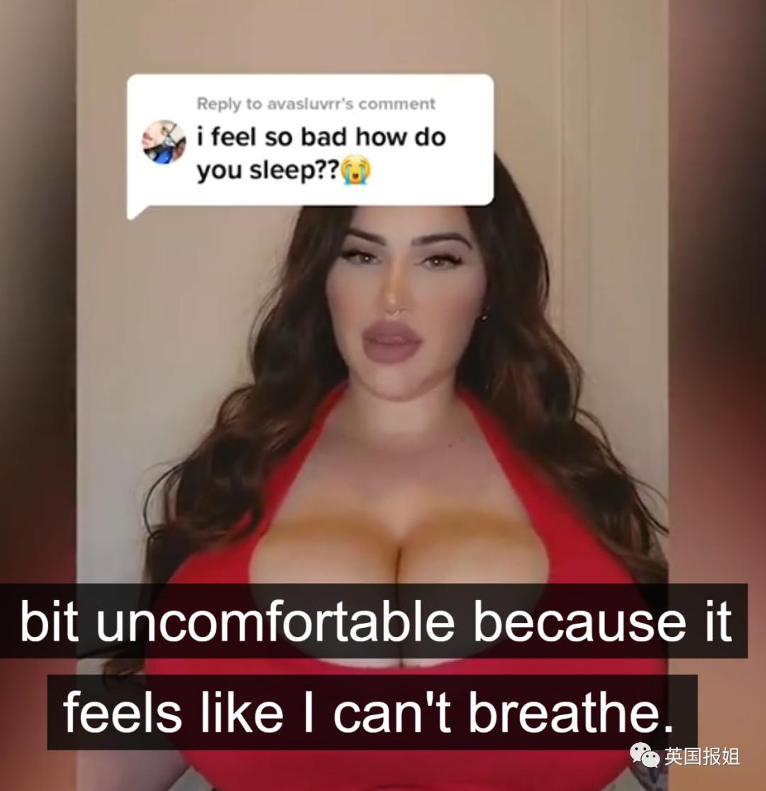 澳洲网红患上“巨乳症”,一年胸围暴涨6个*杯罩**!被压到喘不过气