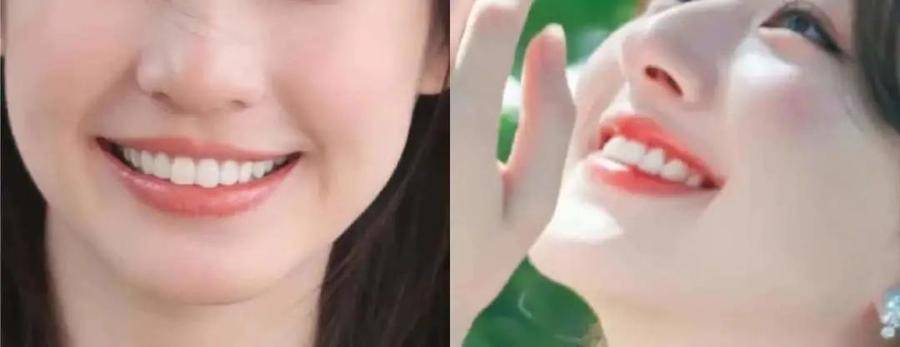 国民初恋毁容了,国民初恋盛世美颜