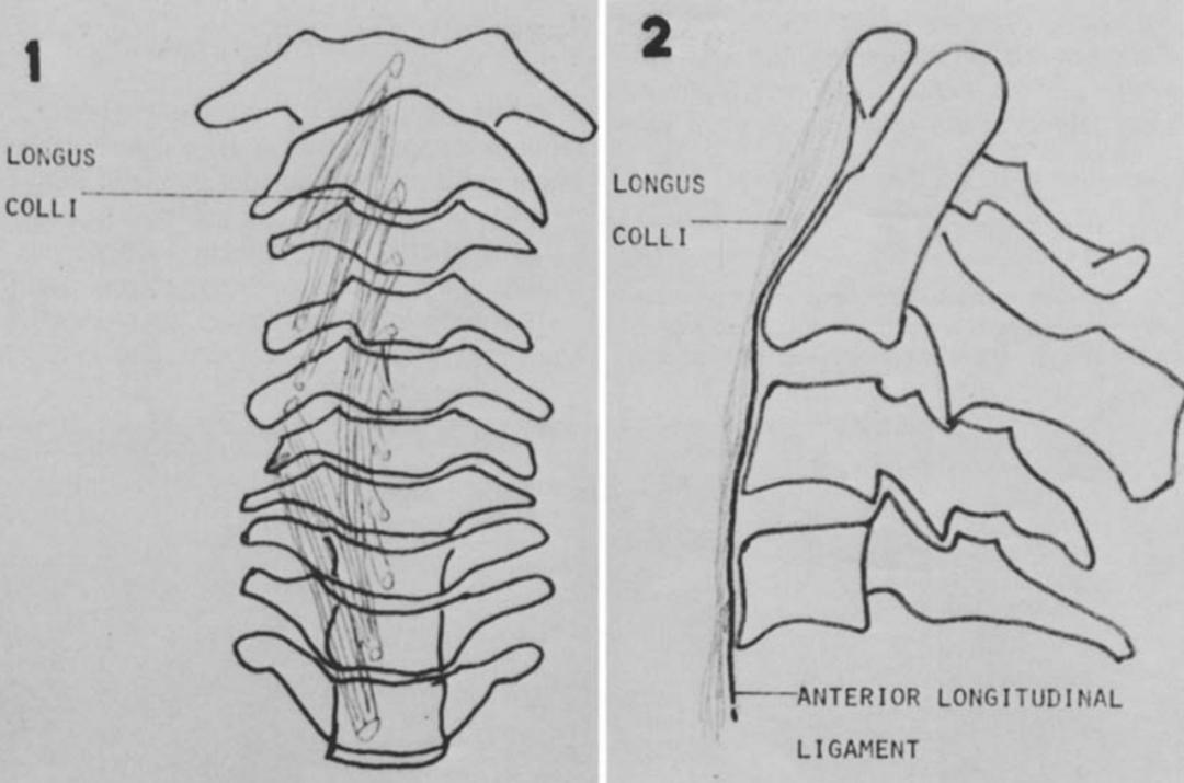 颈椎常见病变图片,颈椎严重的病例