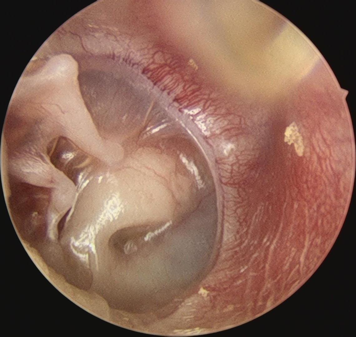 不远万里求医,不远千里寻医