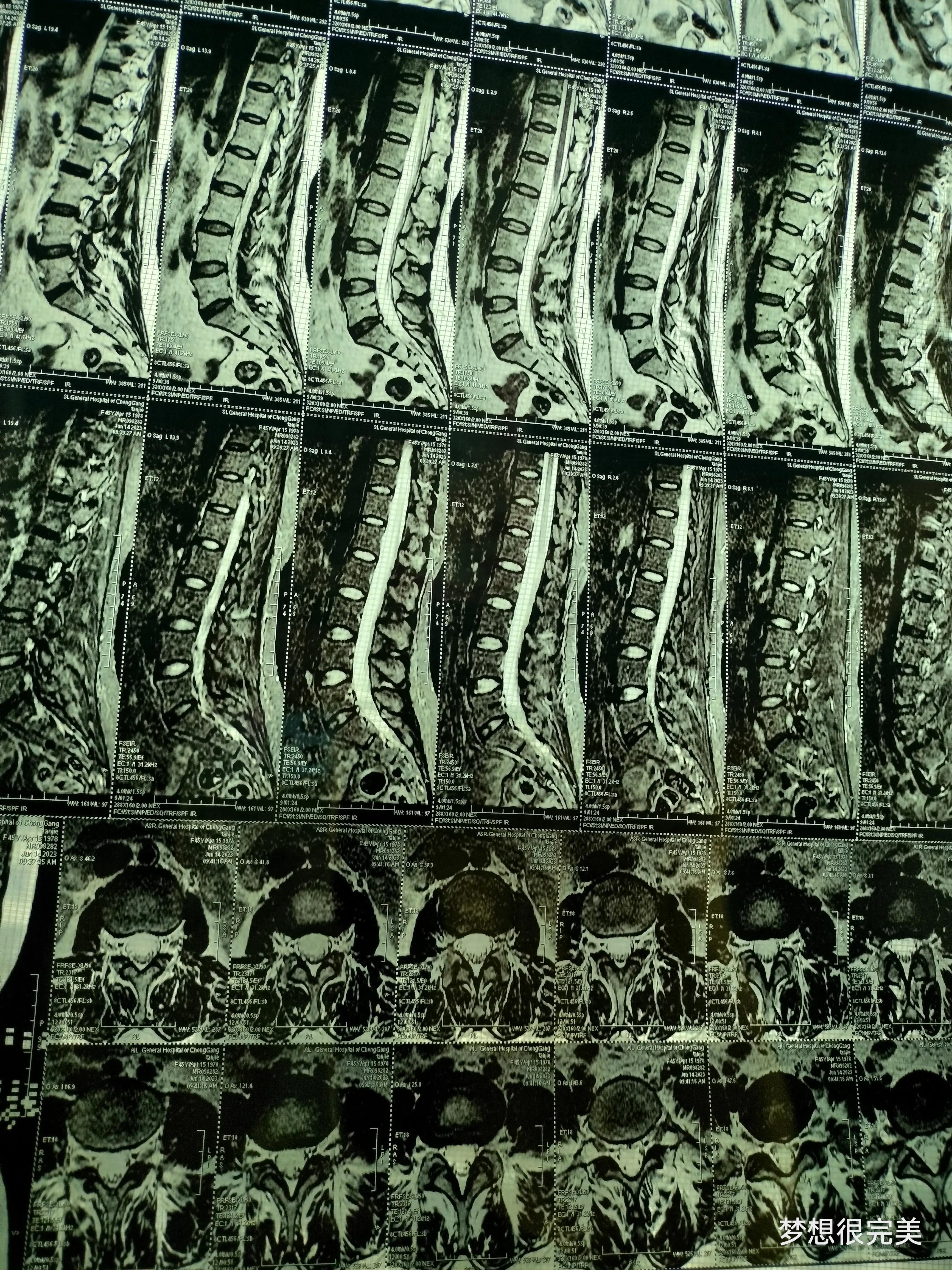 妇科核磁共振也是躺着检查吗,核磁共振也是一种射线吗