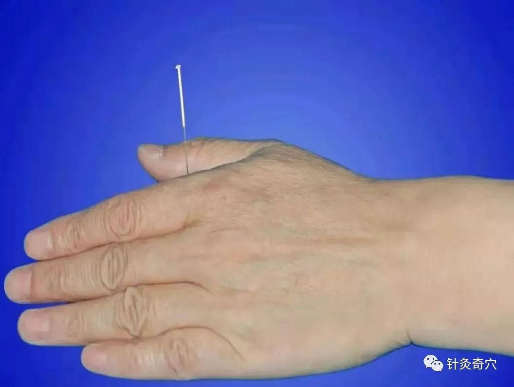 史上最全中医针灸视频教程全集,针灸治疗真实图片大全