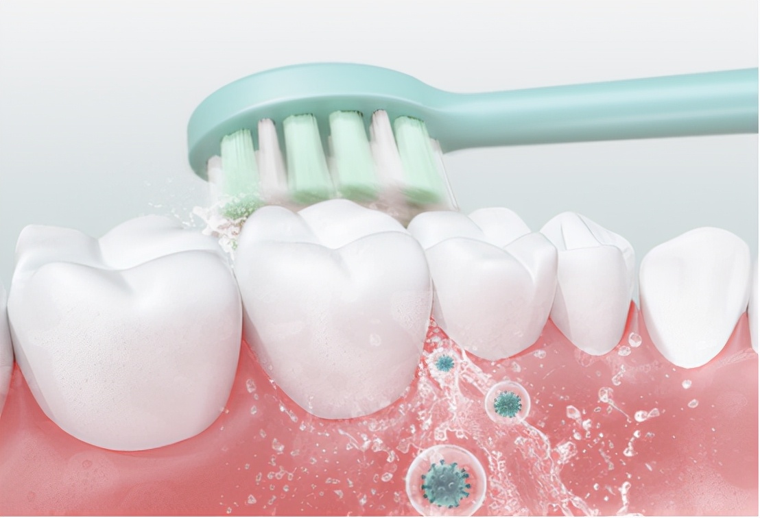 电动牙刷声波震动好还是上下震动,电动牙刷声波震动好还是转动的好