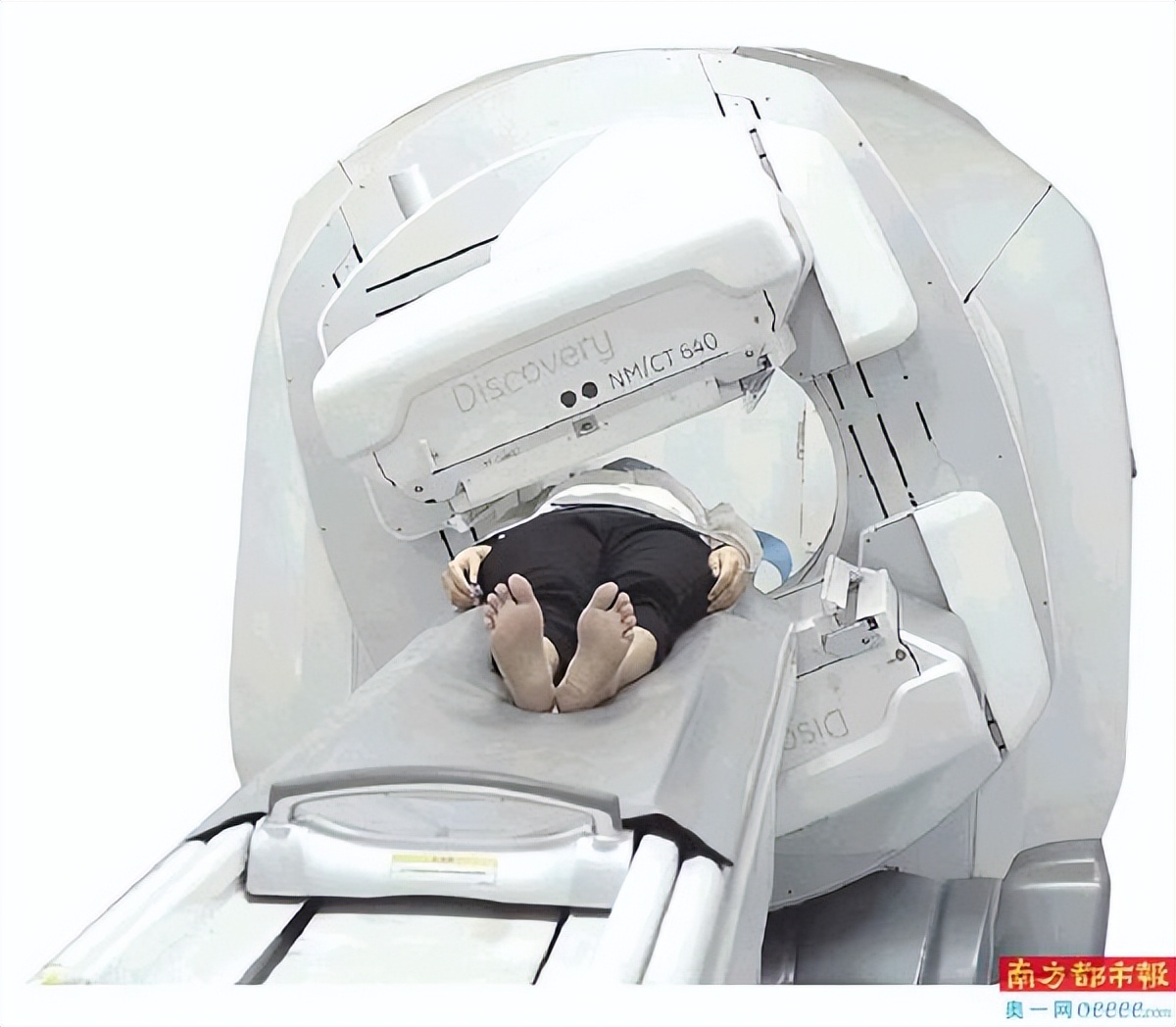 肝癌国外钇90临床免费治疗,国外钇90治疗肝癌最新消息