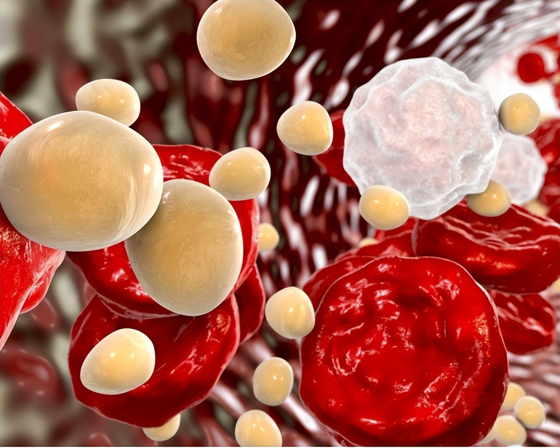 低密度脂蛋白高的2个解决办法,低密度脂蛋白偏高怎么才能降下来