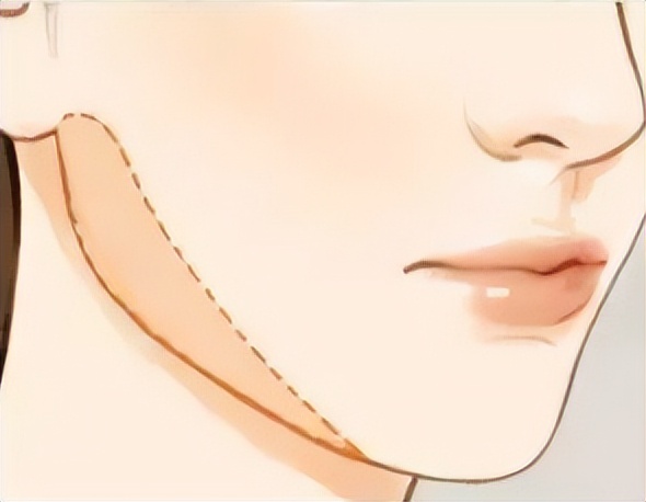 九院韦敏修复眼睛,九院韦敏手术案例