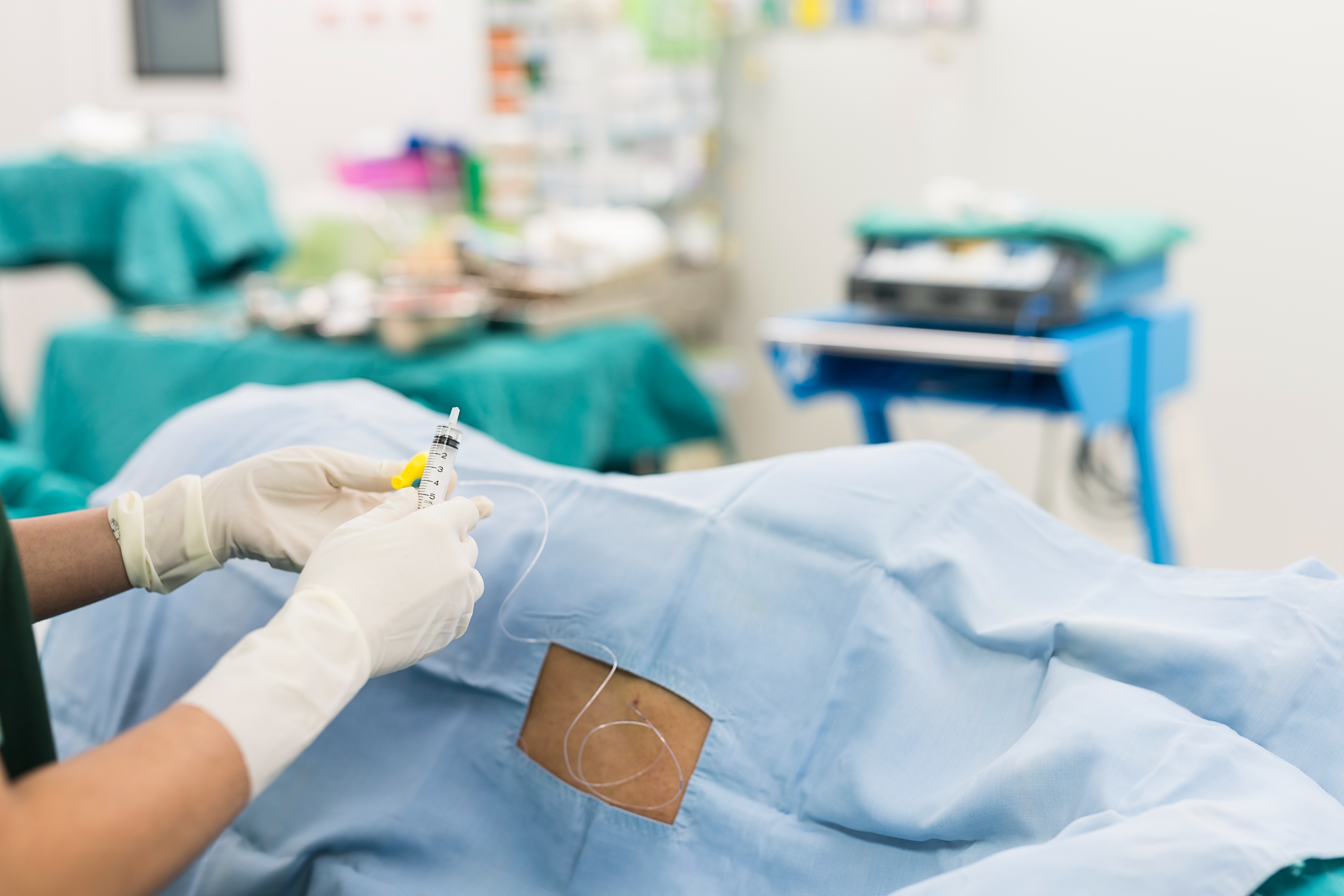 剖宫产需要分娩镇痛嘛,分娩阵痛产妇的观察及注意事项