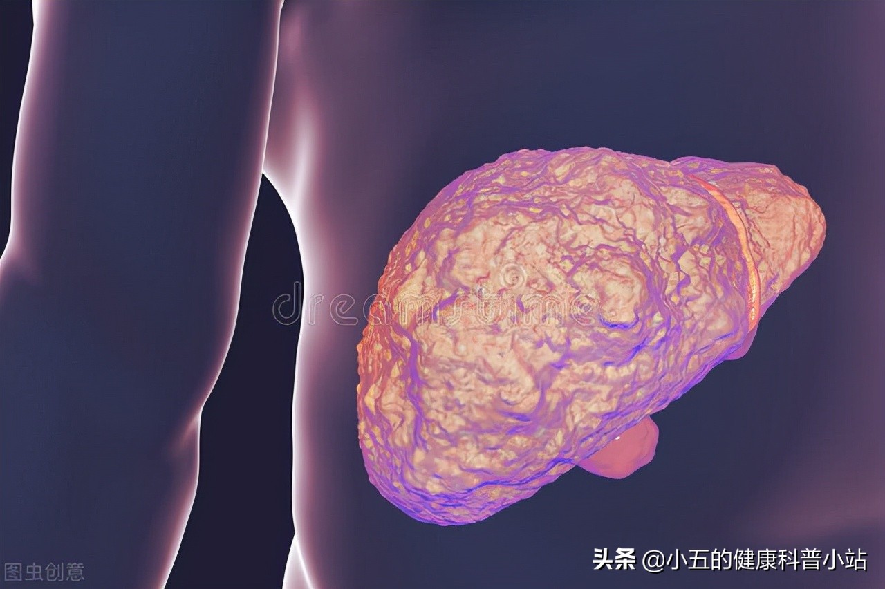 优甲乐能治疗哪些病症,甲状腺功能减退服用优甲乐指征