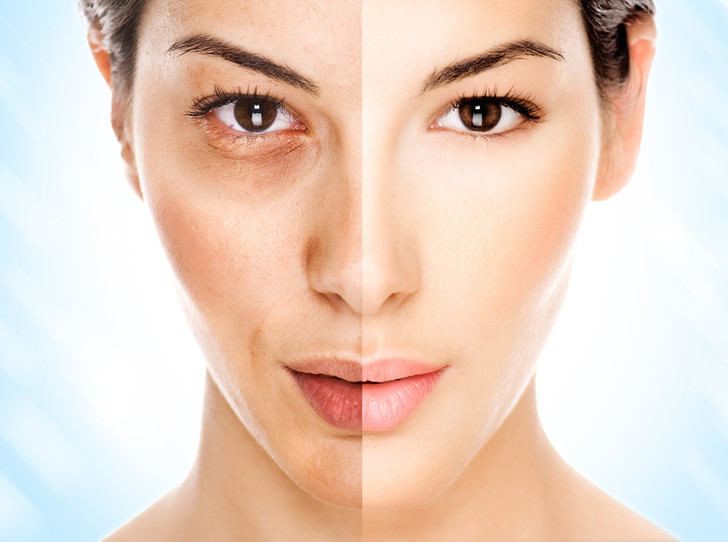 减缓脸部皱纹最简单有效的方法,每天拍打脸部可以消除面部皱纹吗