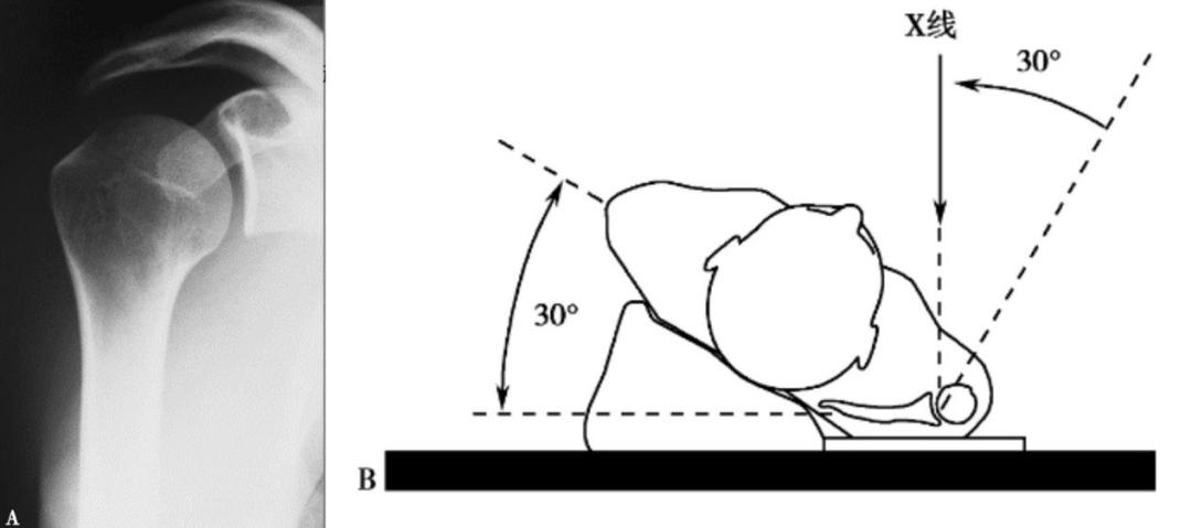 四个注意全面预防骨质疏松,4个要点的剖析