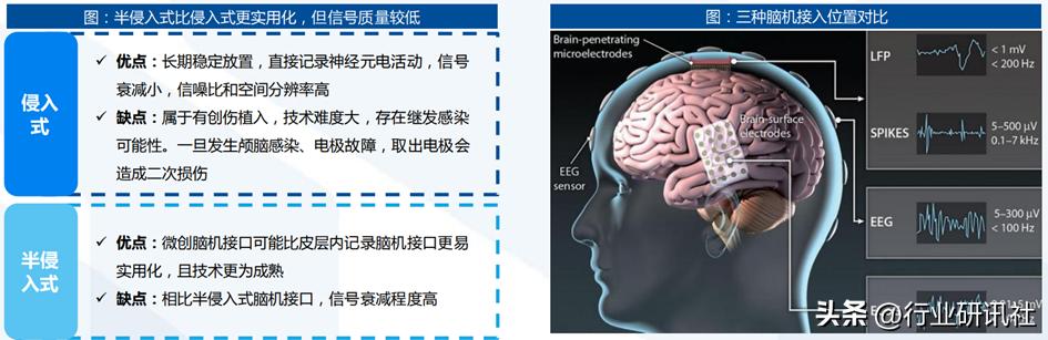 脑机接口发展现状及展望,脑机接口公司靠什么盈利