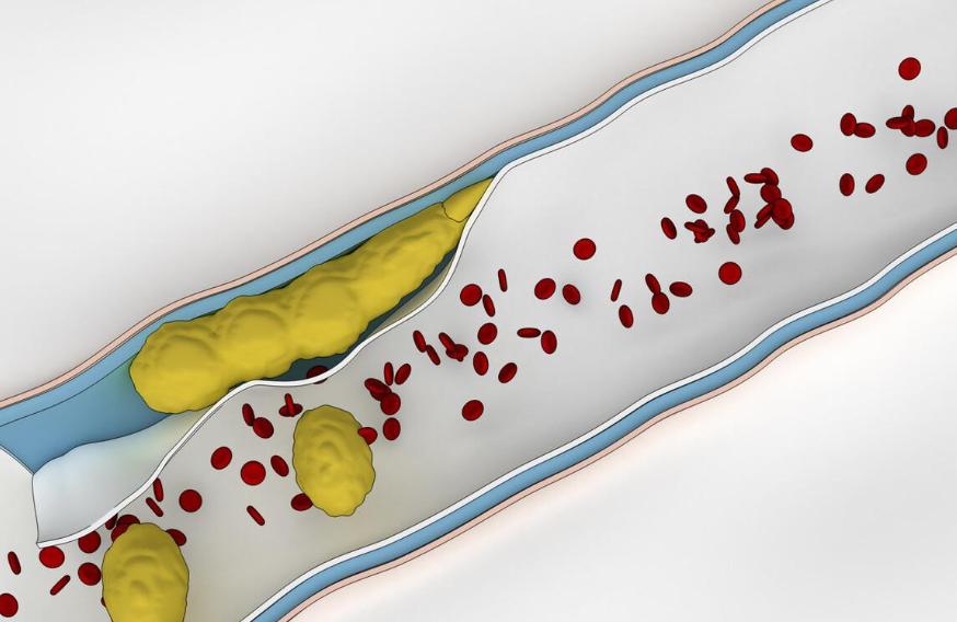 低压高危害和症状,年轻人血压低压高导致什么病