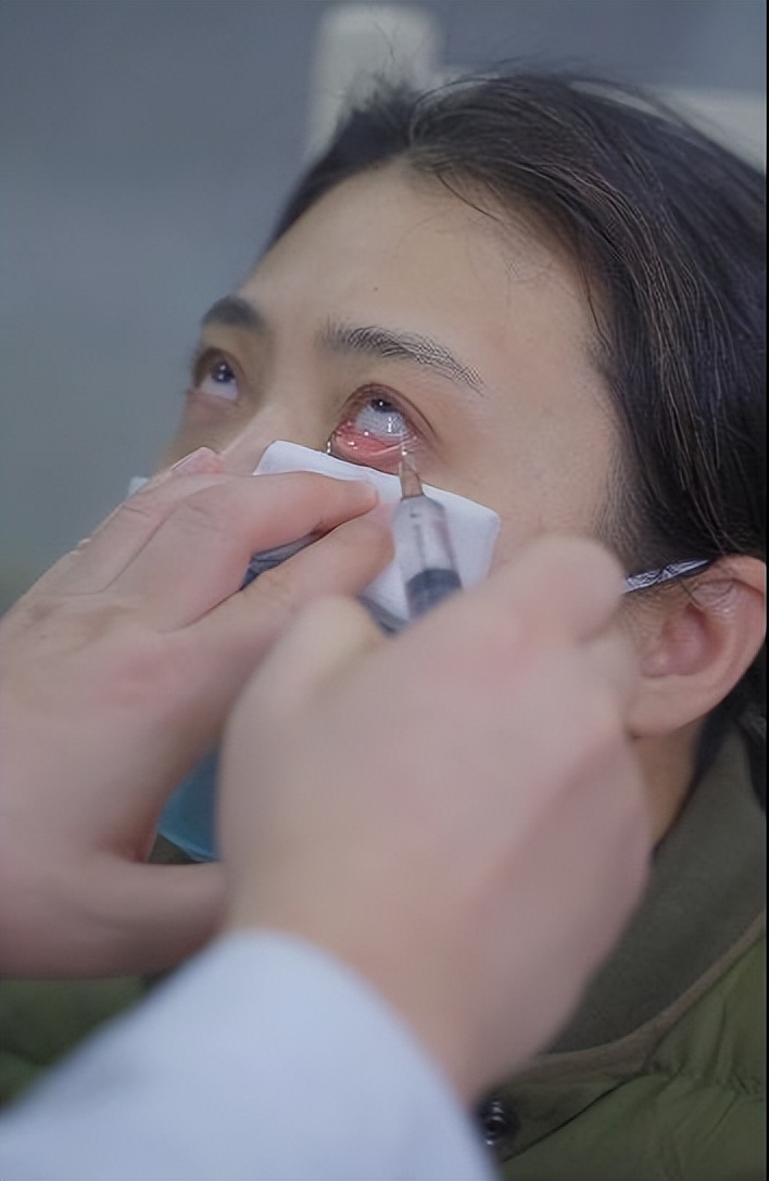 清水洗眼睛保护眼睛,清洗眼睛的护理方法