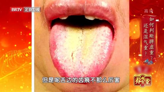 体内湿气重喝什么汤祛湿气,春季湿气重常喝这碗汤能祛湿毒