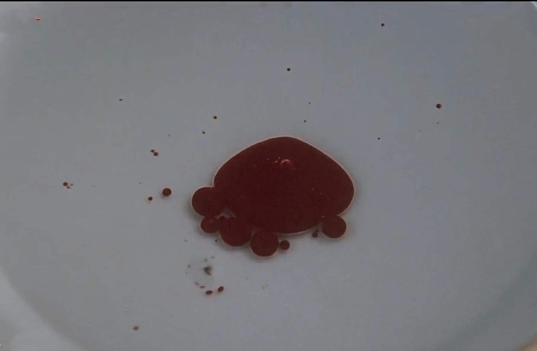 甄嬛传中银针试毒在哪一集,甄嬛传银针试毒片段