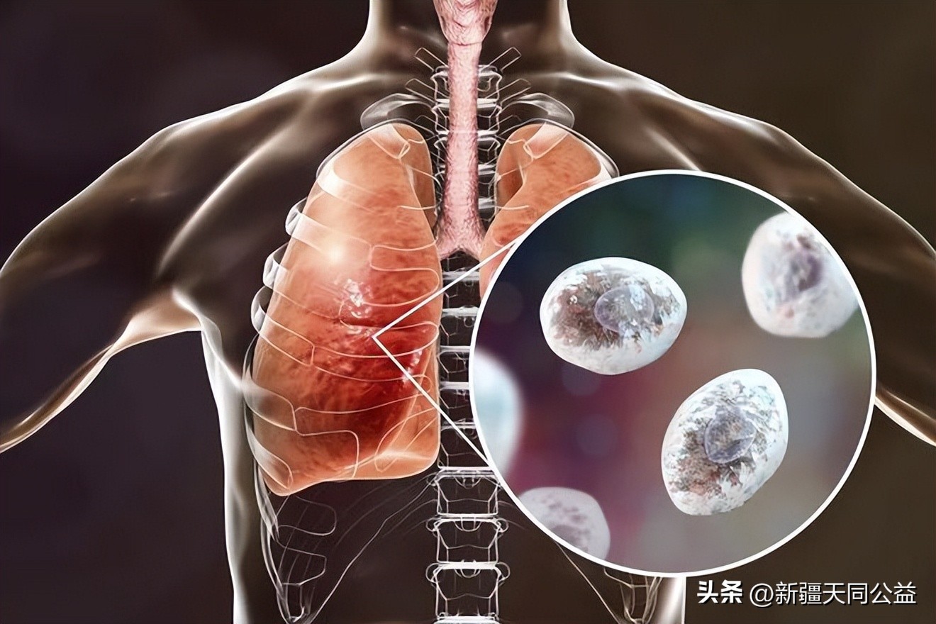 人类有望什么时候治愈艾滋病,人类攻克艾滋病毒还需要多长时间