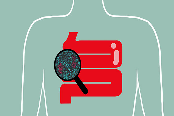 女性更容易尿路感染是什么原因,女性尿路感染最常见的致病菌是