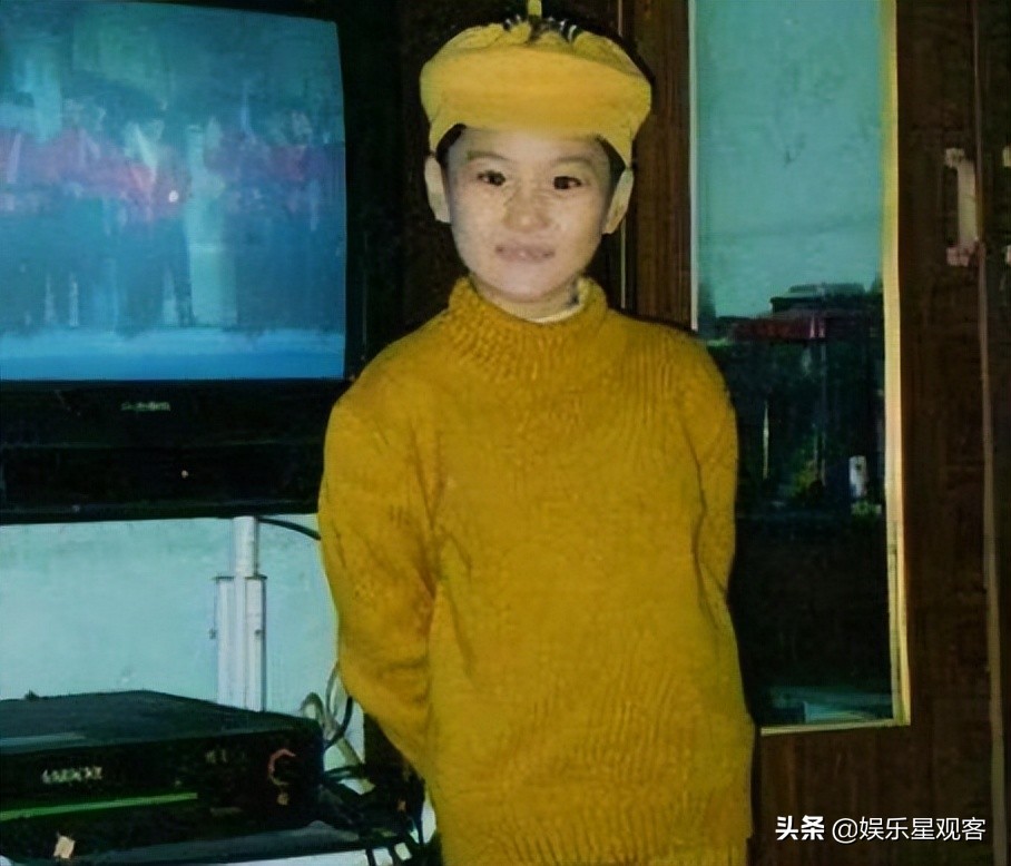 有种整容叫张馨予,张馨予为什么和李晨分手