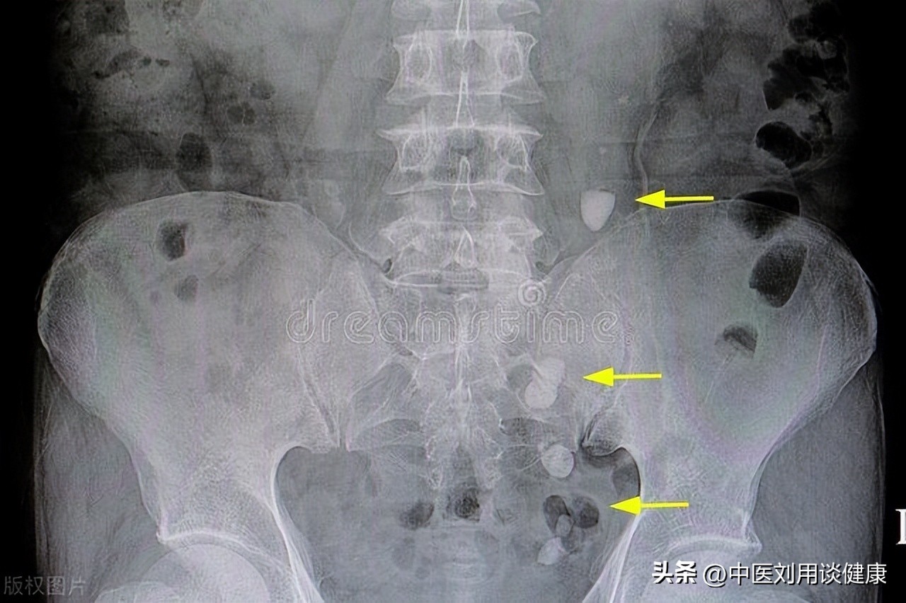 膀胱问题吃什么,膀胱问题导致的尿频吃什么中成药