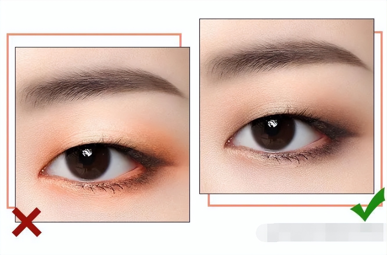 单眼皮肿眼泡如何不贴双眼皮消肿,单眼皮肿眼泡怎么消肿最快